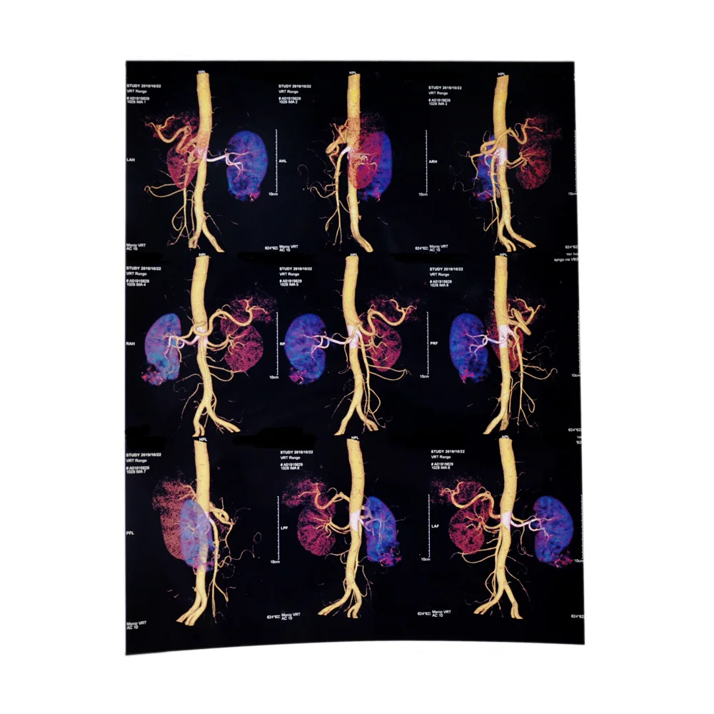 
Class I instrument classification medical radiology film for radiology endoscopic ultrasound 