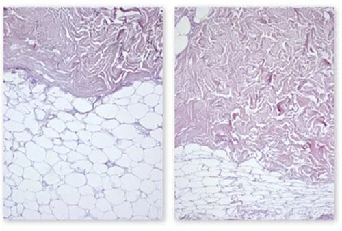 6D-Lipo-Laser-Slimming-Machine-With-16-Pads-635nm-650nm-780nm-810nm-940nm-980nm-Diode-laser-light-therapy-machine