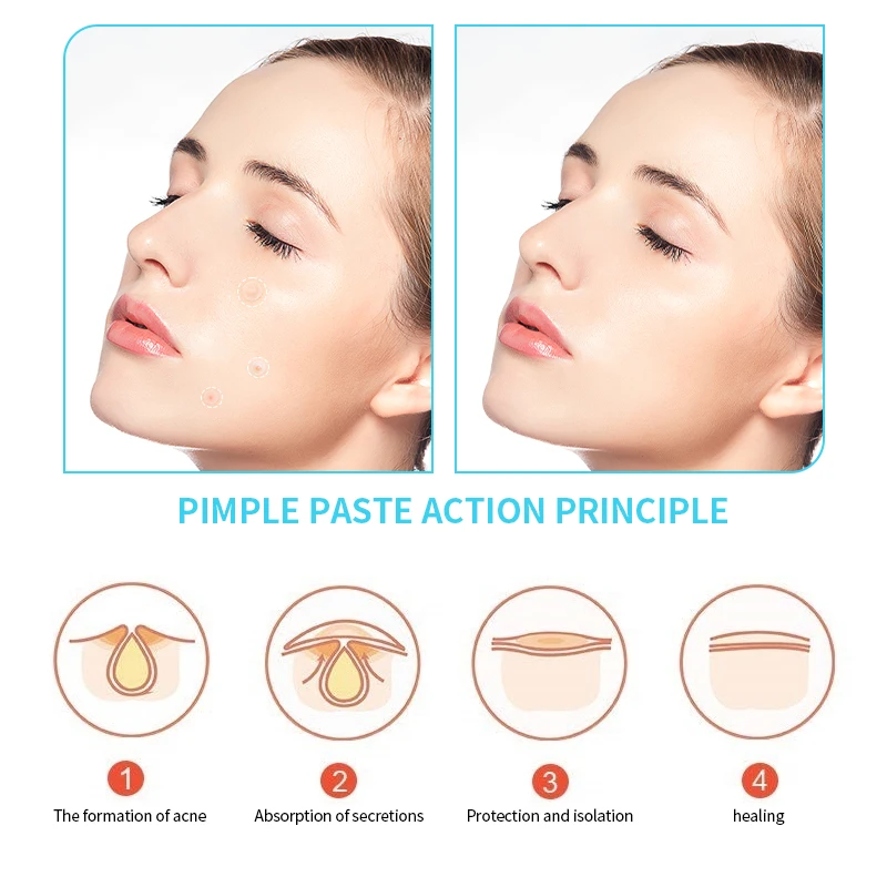 Factory Price Invisible Hydrocolloid Acne Star Face Pimple Healing Spot Microneedle Acne Scar Patch