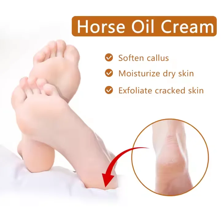 Private Label Wholesale Organic Refined Shea Butter Horse Oil Foot Cream Moisturiizing Skin Care Callus Remover Balm