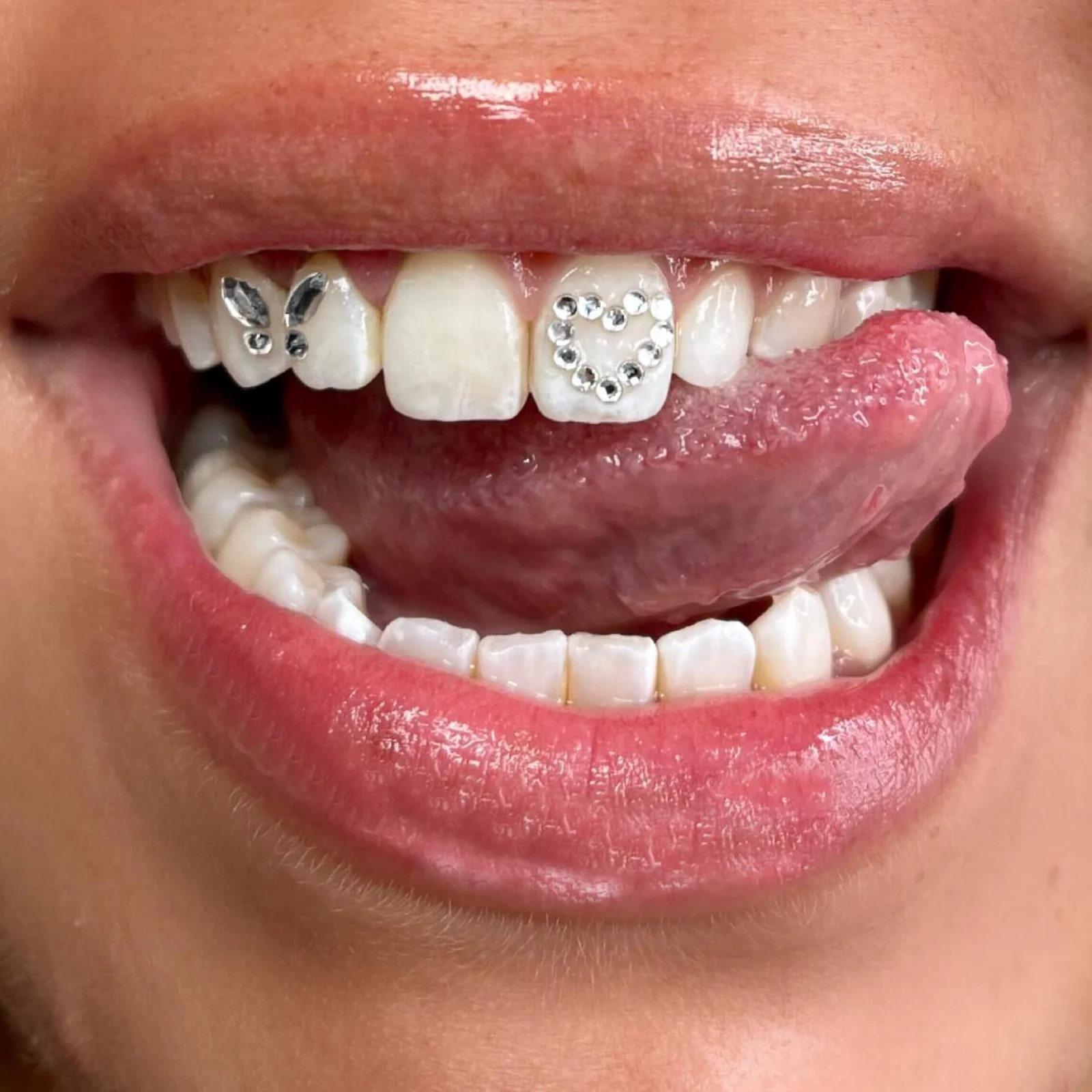 Hot Selling Dental Butterfly Teeth Gems Horse Eye Round Shape