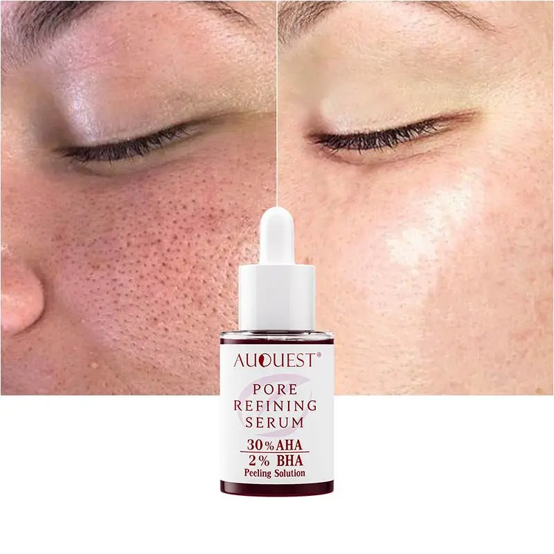 Pore Refining Serum 30% AHA 2% BHA Peeling Solution Shrink Pores Eliminates Pimples Diminish Pimple Marks Essence