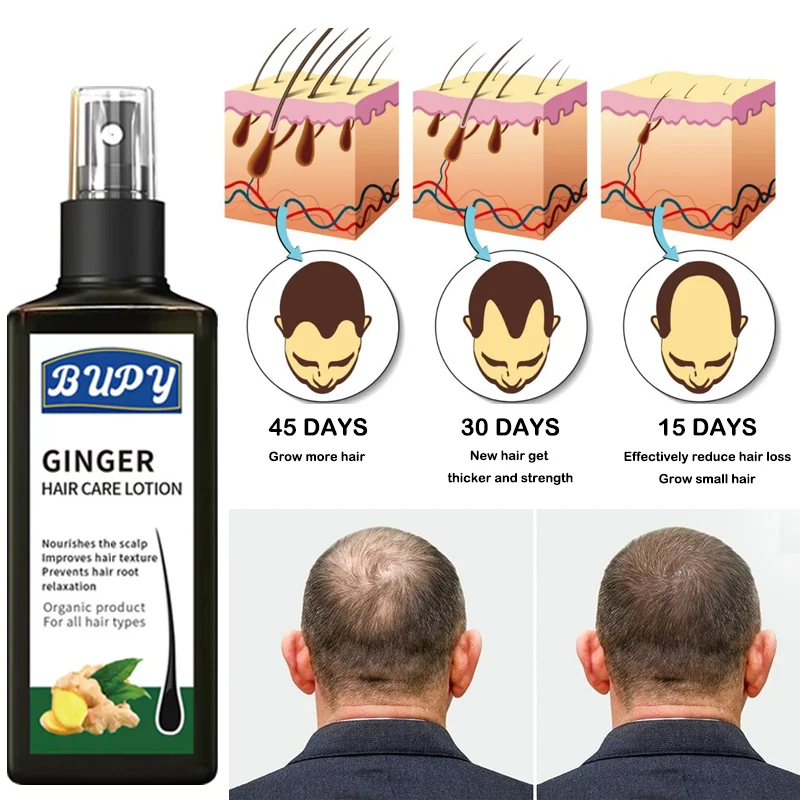 New Arrival Organic Hydrated Moisturized Nourishing Ginger Hydrating Hair Lotion Spray For Hair Growth