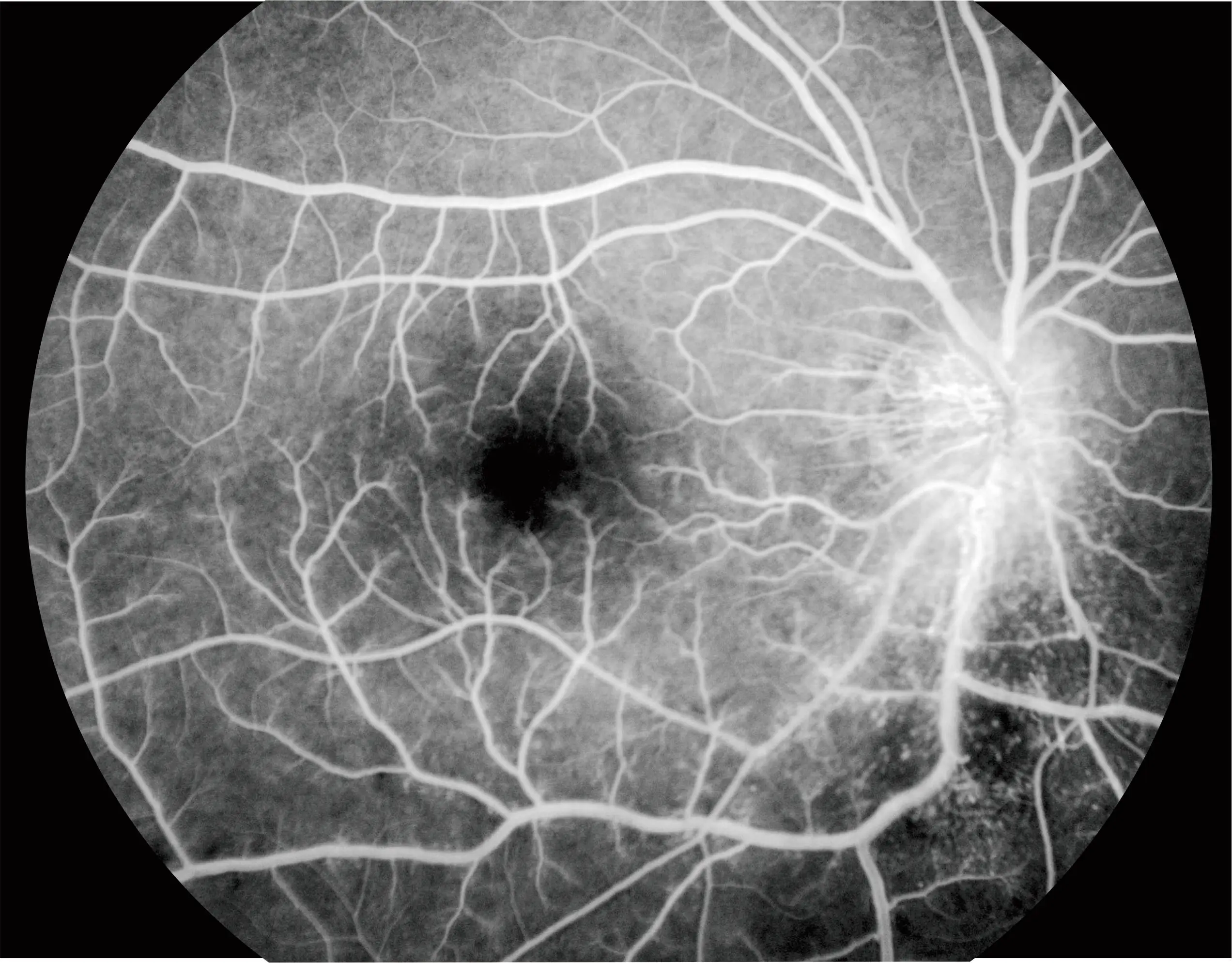 Высококачественная офтальмологическая камера Aps Non Mydriatic Eye Fundus