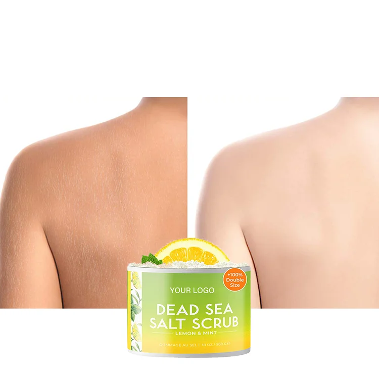 24K Gold Vitamin E Face Cream Super Eclaircissant Diamond Gluthatio Comprime Freckle Removing Whitening Cream