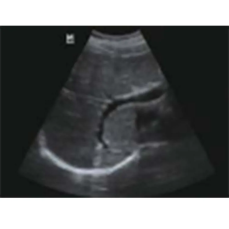 DP-10 Digital Diagnostic Mindray Ultrasound Machine Portable Doppler Medical Ultrasound Instruments