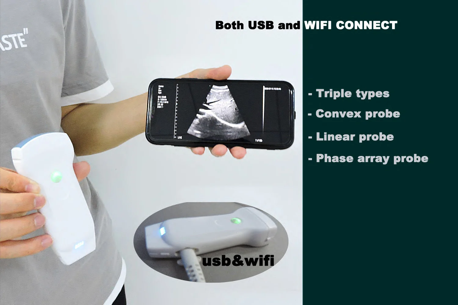  Высокое качество 128 элементы 3 в 1 цветной допплер Wi-Fi и USB Ультразвуковой выпуклый линейный сердечно-сосудистых двойной зонд
