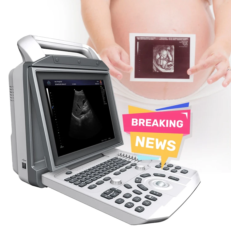 Portable Ultrasound Machine Portable Digital Ultrasound MSLPU46