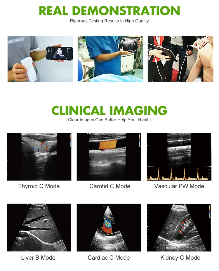 MT MEDICAL Portable Ultrasound Scanner Doppler Micro Convex USB Wifi Wireless Probe Ultrasound Probes