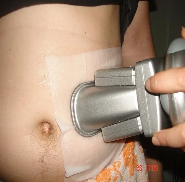 25*42 см, горячая распродажа, крио, мембрана антизамораживания, мембрана антифриза для машины для замораживания жира