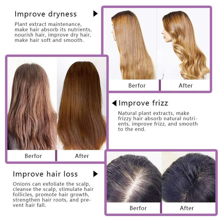 OEM/ODM Hair Care 500ml Onion Hair Fall Control Shampoo with Onion Oil &Plant Keratin Hair Loss Shampoo
