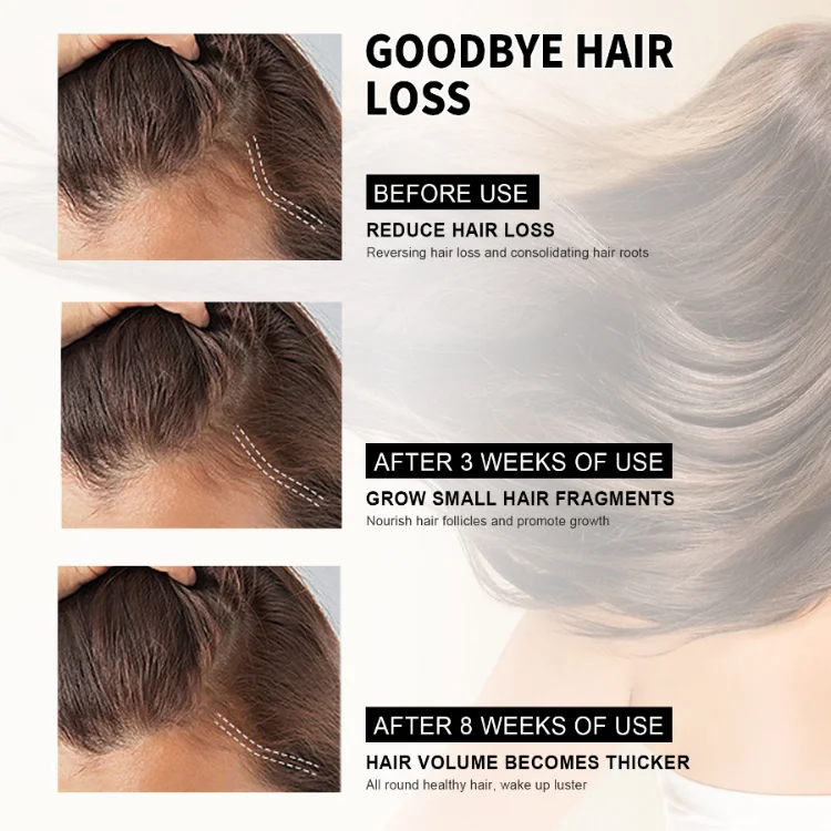 60ml Fast Hair Regrowth Serum Black Seed Castor Hair Growth Serum Oil Thick Hair Fast Growth For Black Women_17