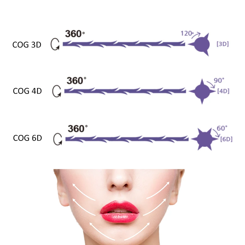 Hot-selling TOP-Q Medical Cog 2-1 Hios Pdo Thread Tensores Facial Nose Lifting Fio Yarn Barb