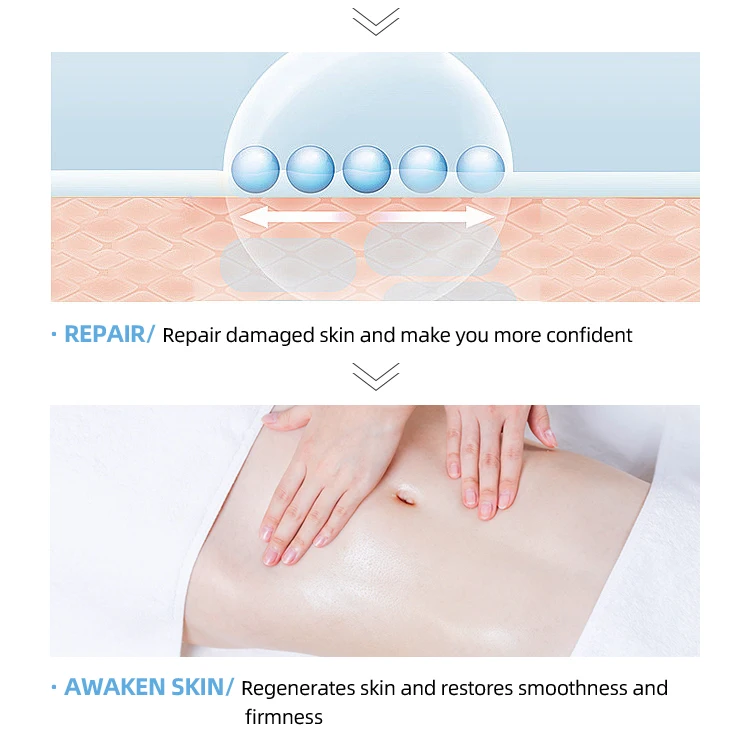 HODAFScar Silicone Gel Sheets Skin friendly adhesive scar removal Silicone Tape