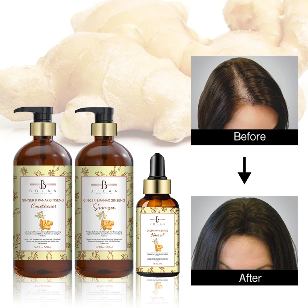 Wholesale Shampoo de Ginger Growth King Ginger Hair Loss Shampoo and Conditioner Kit