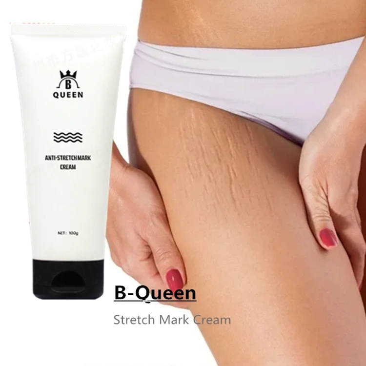 2021 Top Sale Effective Stretch Mark Repairing