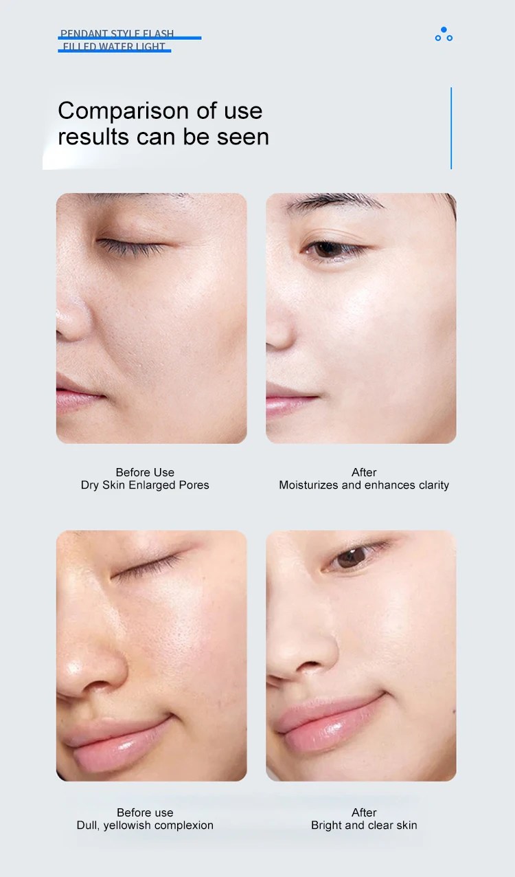 High Pressure Jet Technology Non-invasive Skin Hydration Machine Facial Hydration Water Machine Pore Cleansing For Salon Use