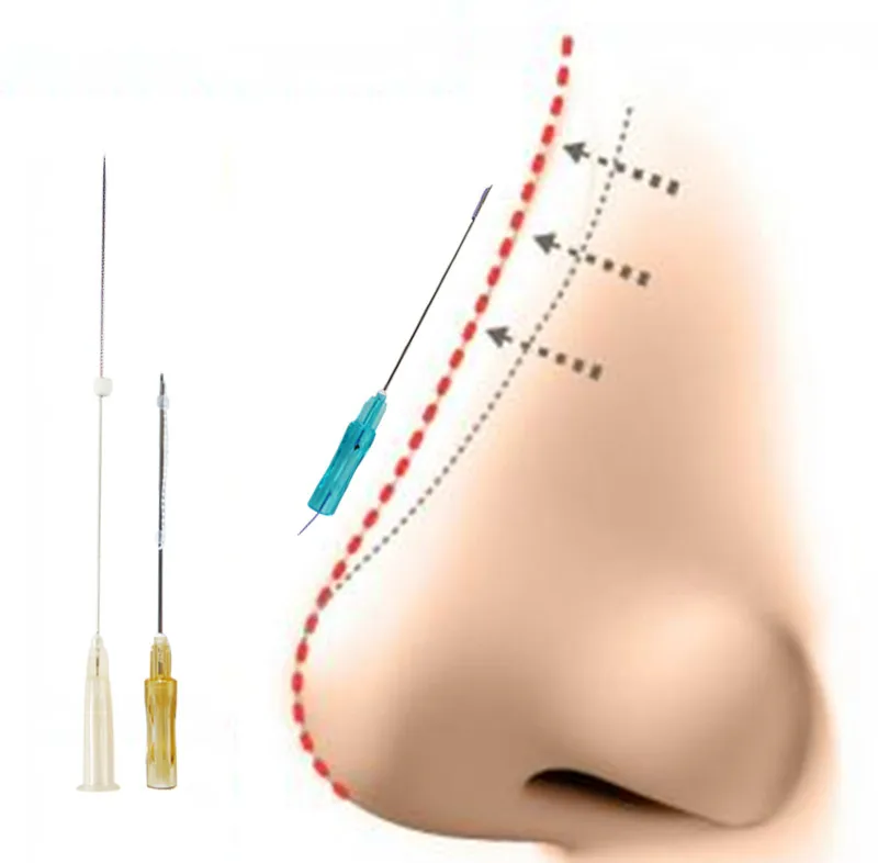 tag ring pdo thread lift double needle cog pdo thread