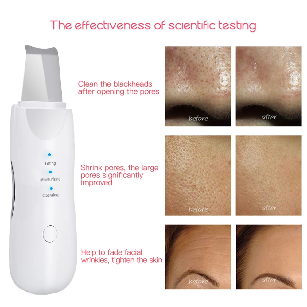 Ultrasonic Facial Spatula Skin Scrubber Beauty Cleaning Care Peeling Deep Blackhead Dead Electric Skin Scrubber