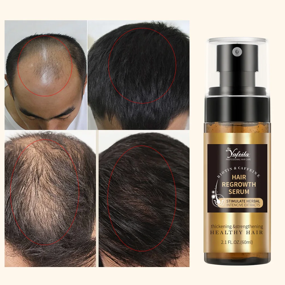 Factory Bulk 60ml Biotin Hair Growth Spray for Men and Women Fast Regrowth Treatment Serum to Stop Hair Loss