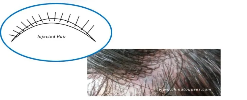 Best Human Grey Hair Injection Toupee/Hairpieces/hair system for men