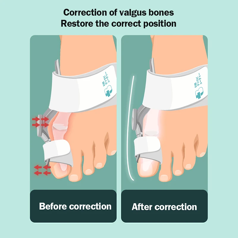 Big Toe Straightener Splint Adjustable Silicon Bunion Toe Protector Straighteners Corrector For Hallux Valgus