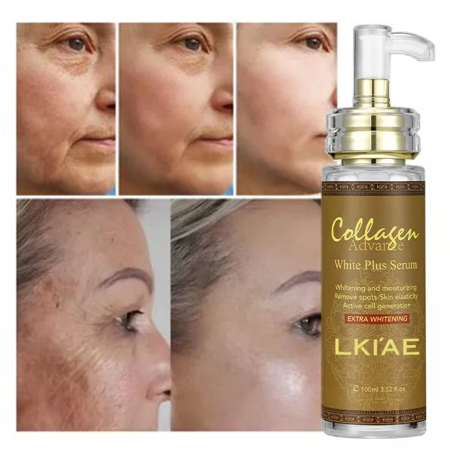 Ailke Organic Skin Care Anti Aging Niacinamide Vitamin C Whitening Hyaluronic Acid Serum For Face