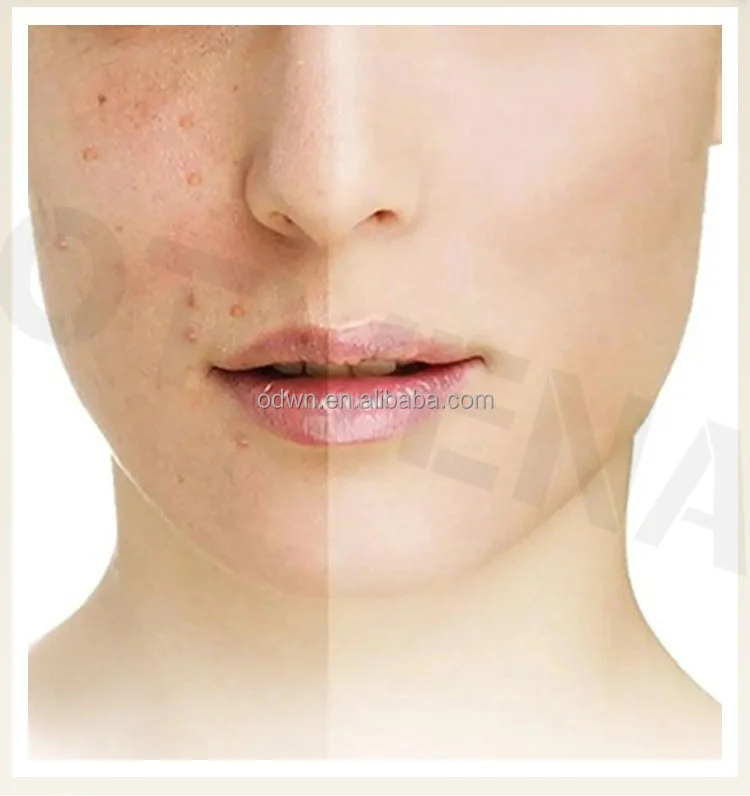 Copper Peptide Acne Treatment Korea Cosmetic Skin Care Powder Serum