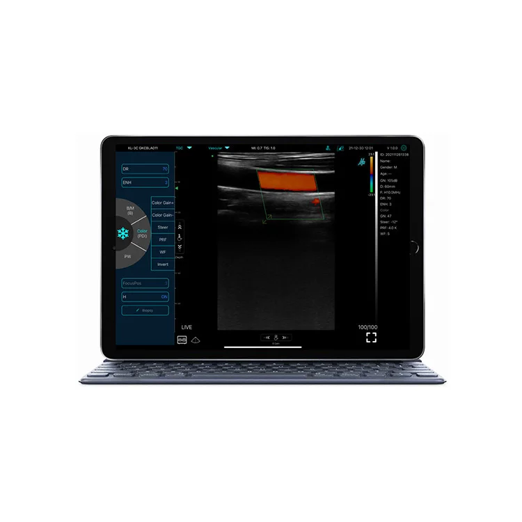 Professional Medical Devices C10RL Ultrasound Vein Illumination System, Infrared Viewer / Portable FinderClinical Analytical In