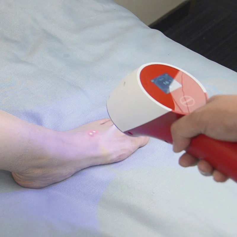 Powerful Co2 Portable Shock Cryo Therapy Device Designed For Fast Pain Relief And Wound Healing With High Performance