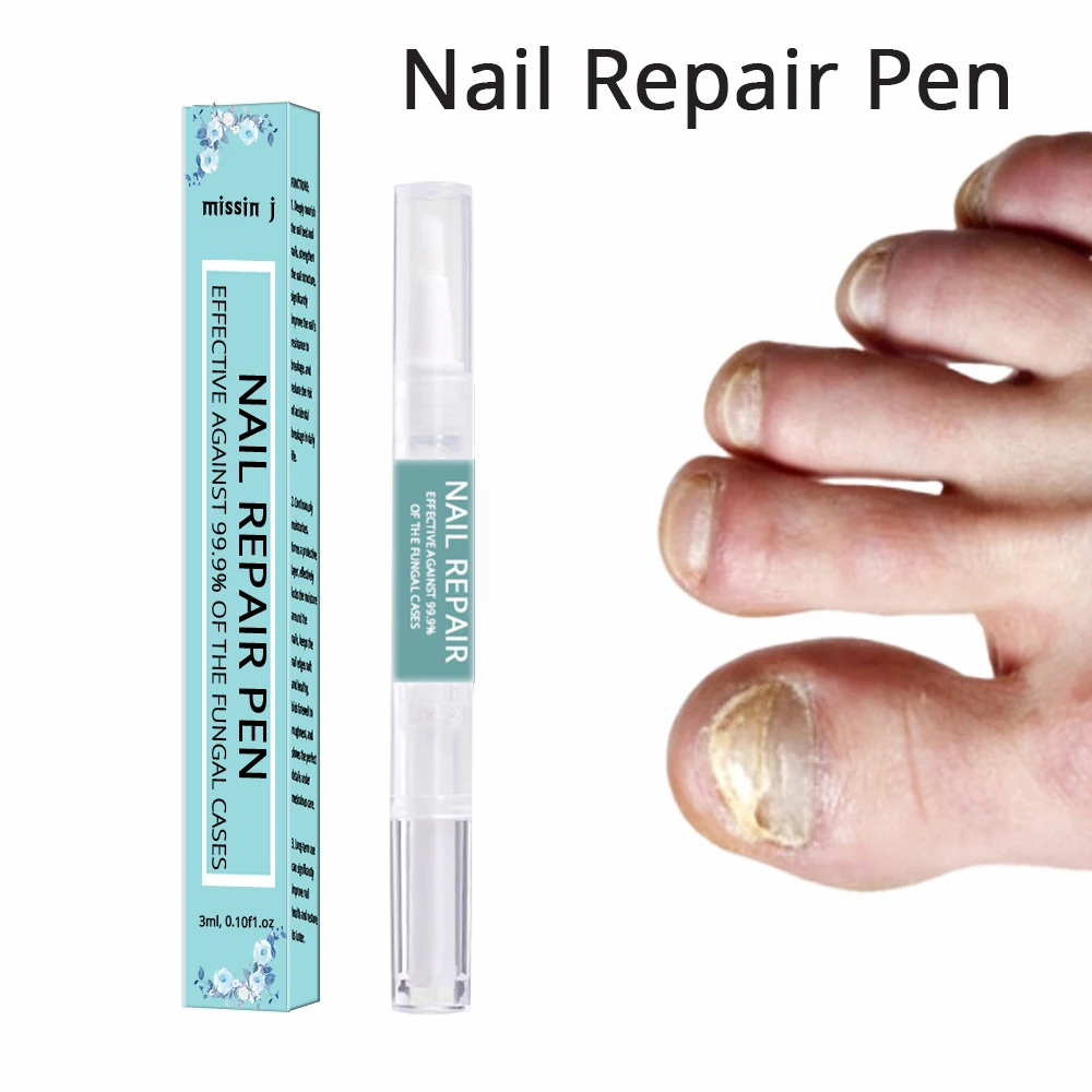 Private Label Anti Fungal Nail Fungus Treatment Repair Pens for Toenail Fungus Infection and Fingernail