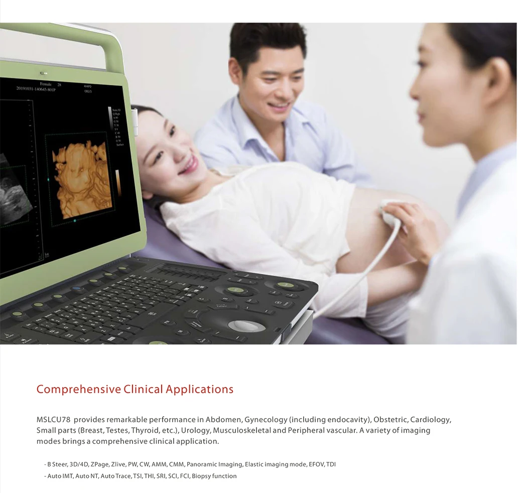 15.6 Inch Portable Color Doppler System Medical 4D Ultrasound Machine for Pregnancy