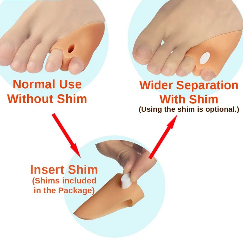Bunion Correction Pad Pain Relief Little Toe Straightener Separator Pad Splint Guard Gasket Guard