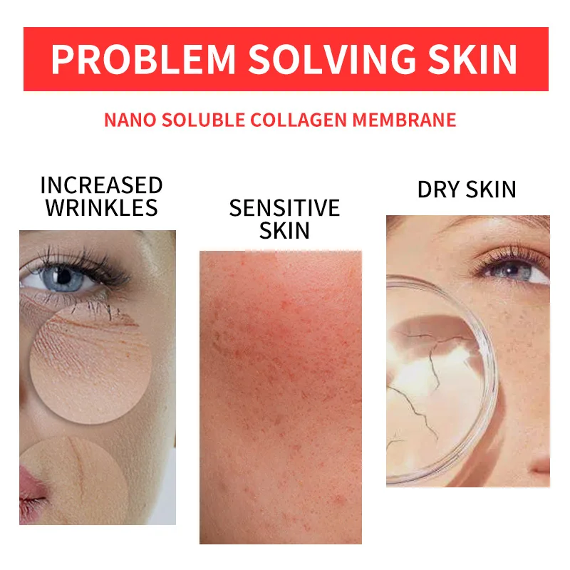 Private label remove forehead nasolabial folds wrinkles lifting Dissolve Type III collagen Forehead cheek facial mask kit