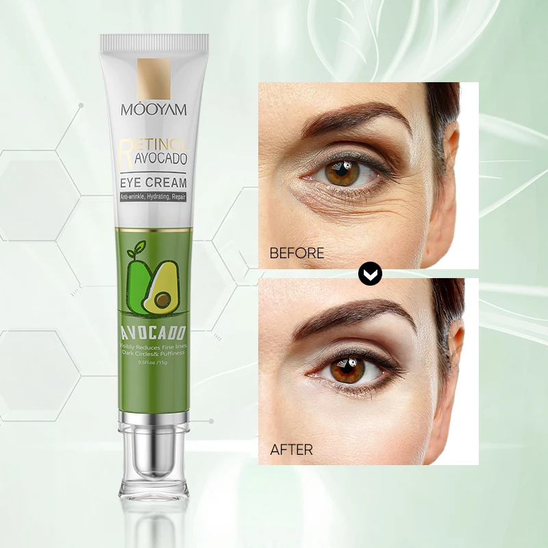Wholesale Retinol Eye Cream, Reduce Wrinkles Fine Lines Retinol Intense Moisturizing Eye Cream