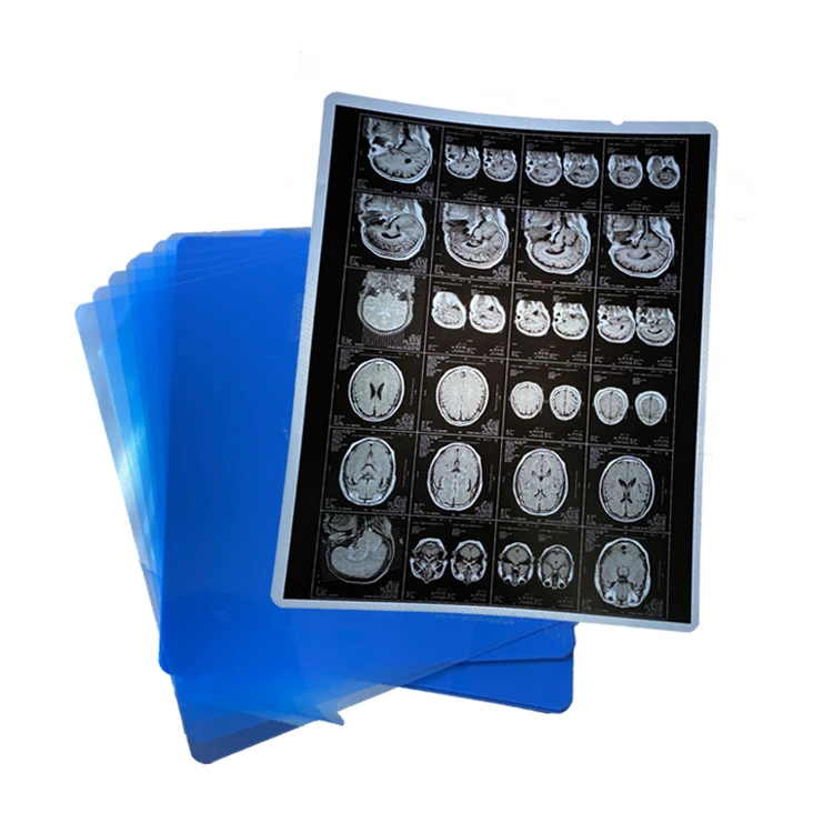 Waterproof PET base medical radiology x ray blue film inkjet printing for epson canon