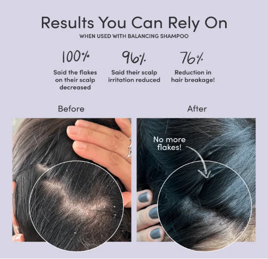 Anti-Dandruff Essence Oily head treatment Improve scalp environment