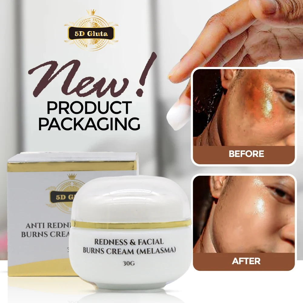 Strong Effective Skin Lightening Reduce Redness Burn Face Face Whitening Freckle Cream Remove Melasma Fade Dark