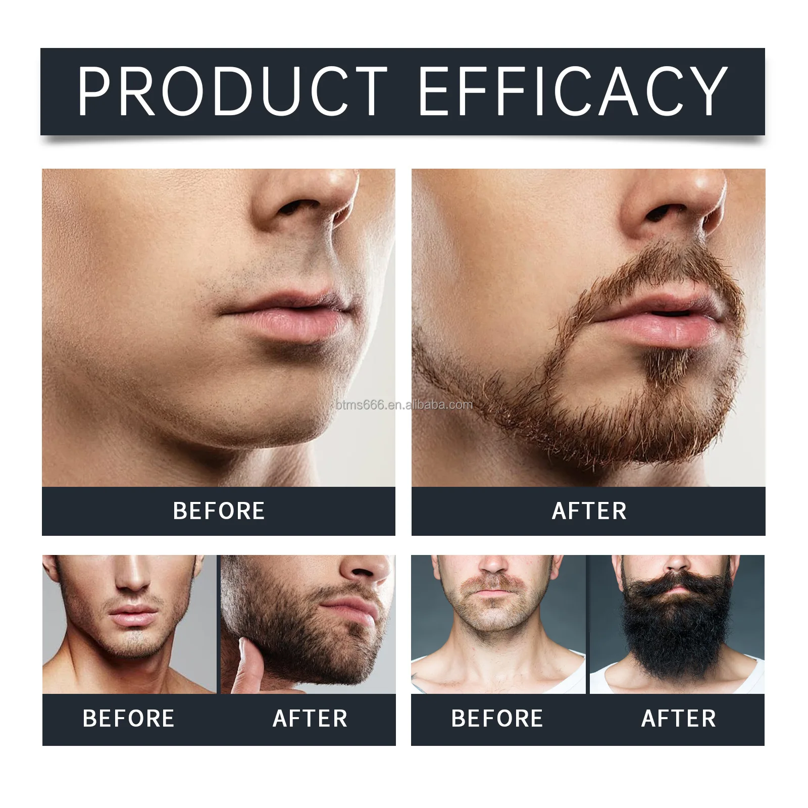 Bettermiss Custom Logo 7pcs Beard Growth Kit OEM Natural Organic Beard Oil Beard Kit For Men Grooming Care Set