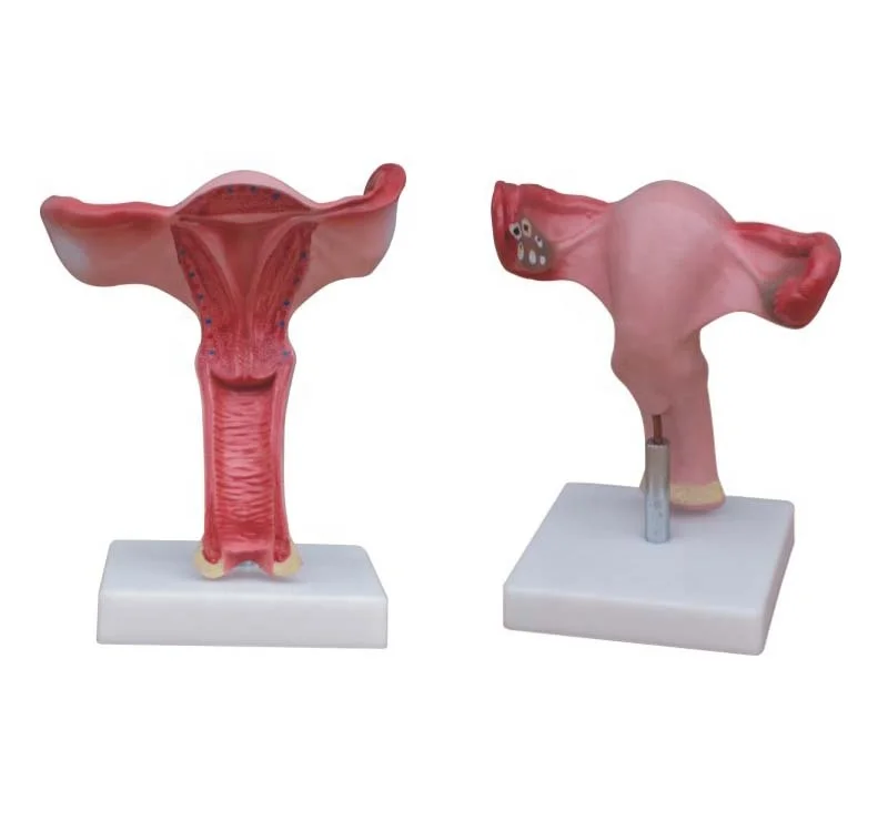 Magnified Uterus Model Hospital school medical teaching human plastic uterus model