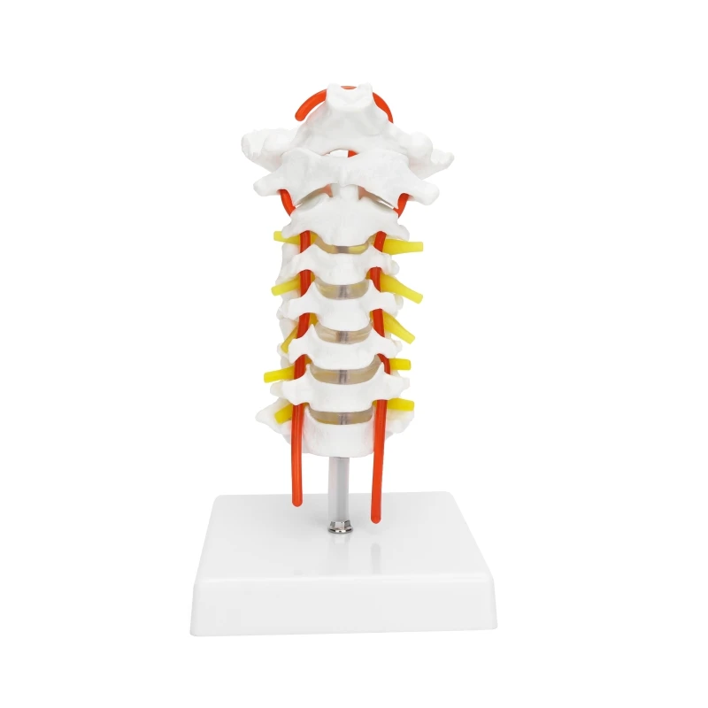 Human Cervical Vertebra Model with Carotid Artery, Cervical Spine Column Model