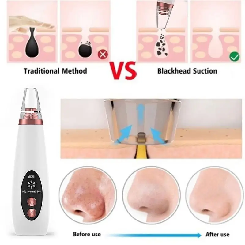 Top Selling Beauty Products 2023 Electric Acne Pore Cleaner Black Head Suction Extractor Vacuum Blackhead Remover Machine
