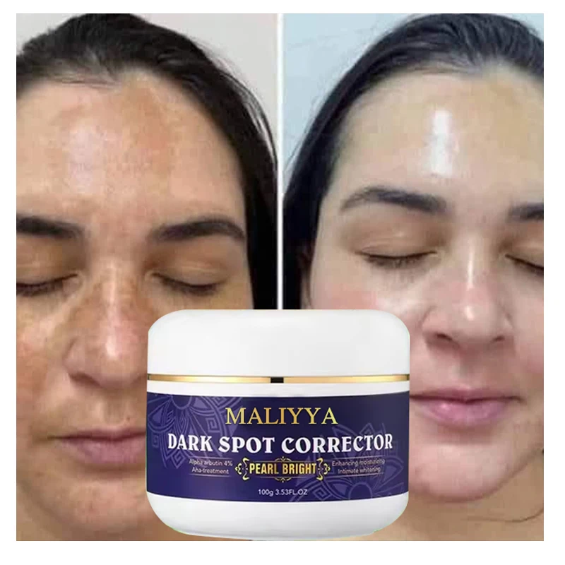 OEM Powerful Spot Removal Whitening Cream Repair Skin Dark Spot Correction Contains Arbutin Vitamin C Serum Natural Facial Care