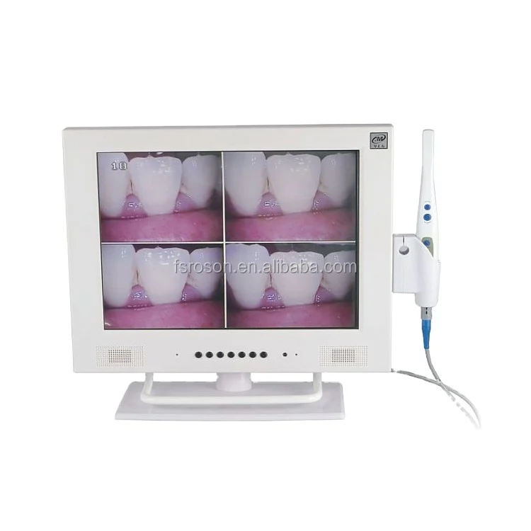 dental intraoral camera with 15 inch monitor price for teeth x ray