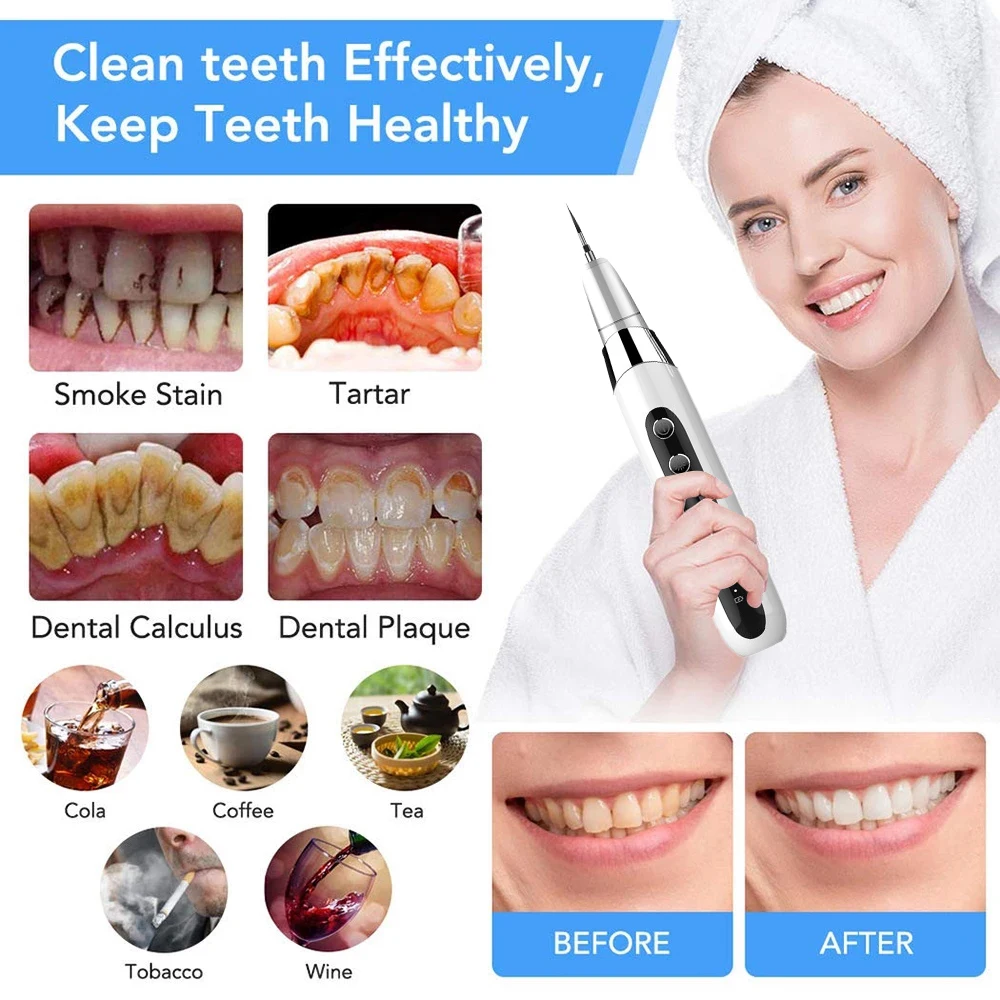 New Electric Ultrasonic Portable Remover Stains Tartar Plaque Whitening With 5 Modes 40KHZ Ultrasonic Dental Scaler