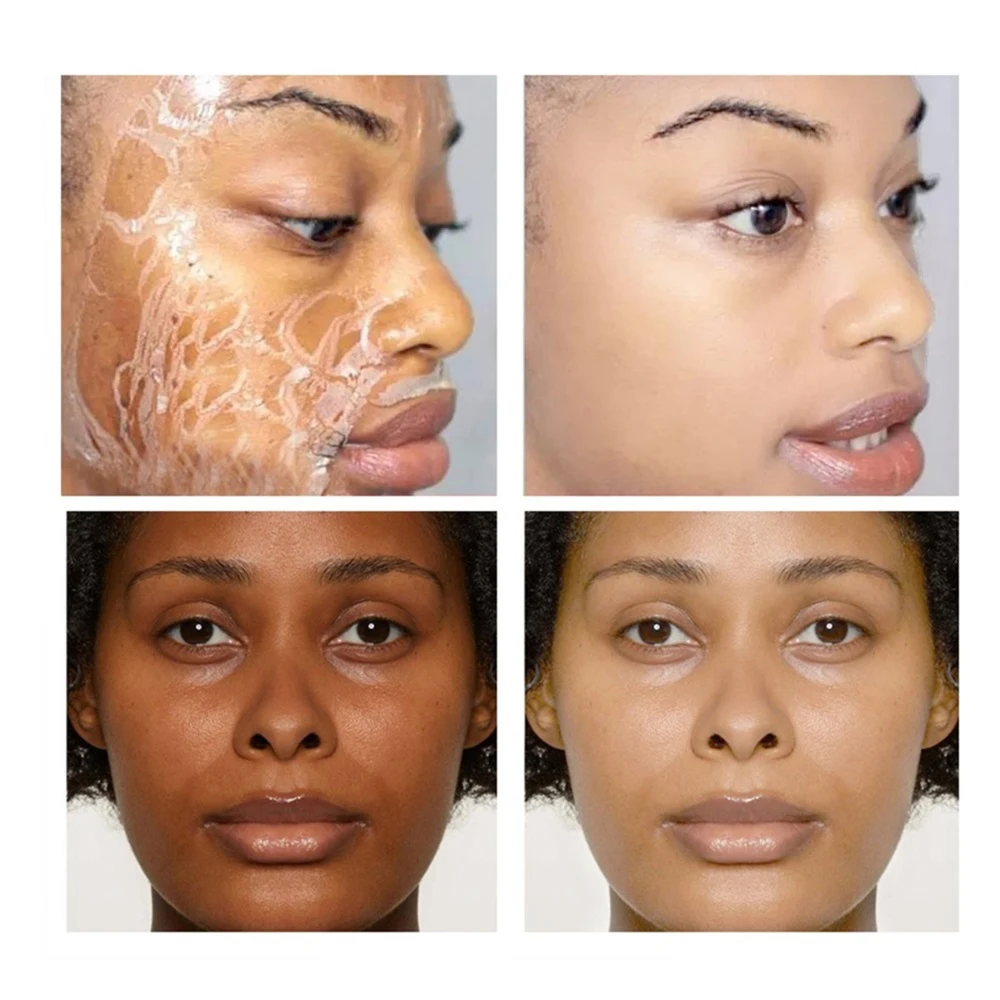 Custom Remove Dead Skin Exfoliating Face Orange Body Lotion Peeling for Lightening Whitening Exfoliating