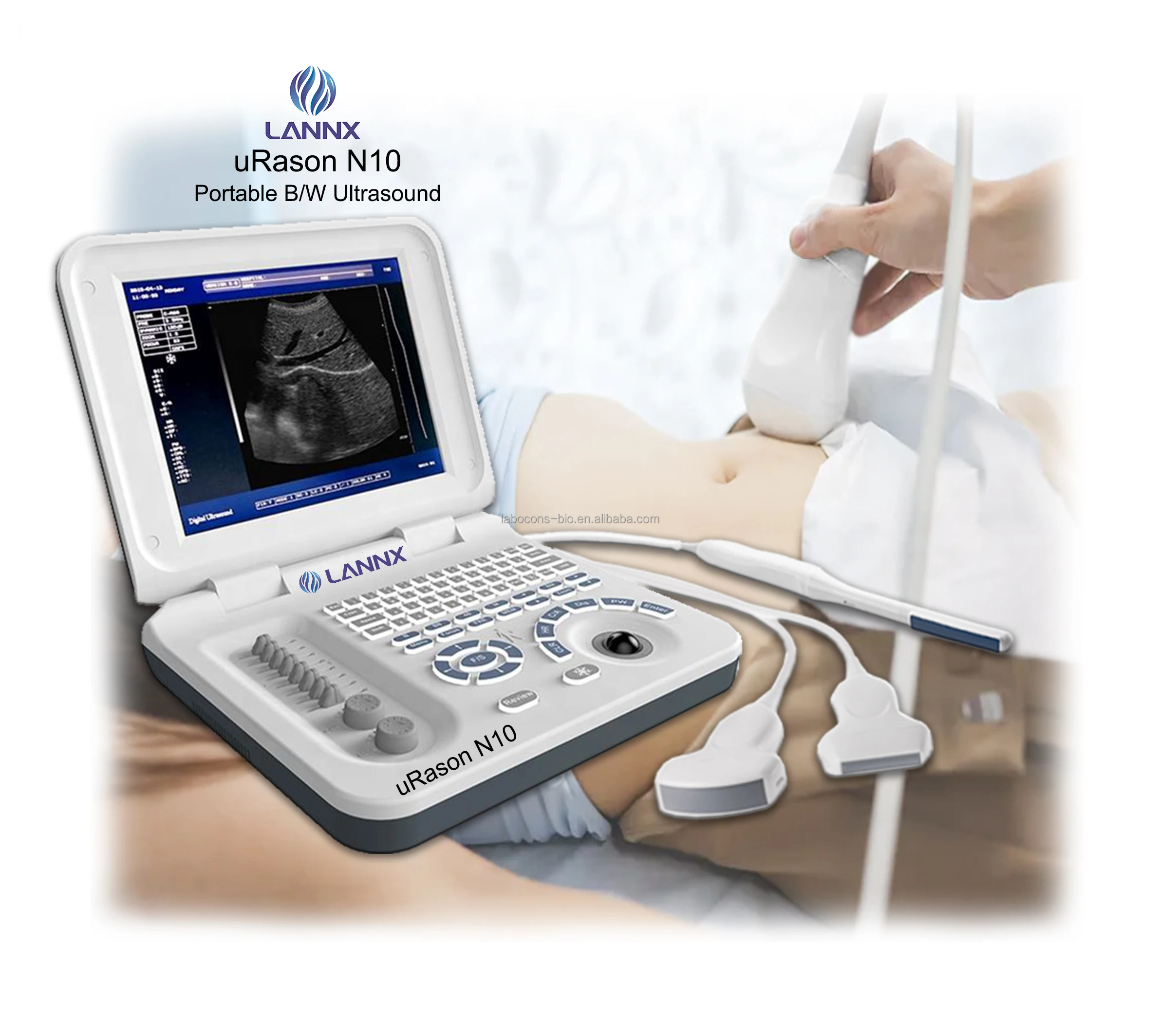 LANNX uRason N10 Priced to sell Medical echocardiography machine Laptop Ultrasonido Portatil B/w Ultrasound scanner system