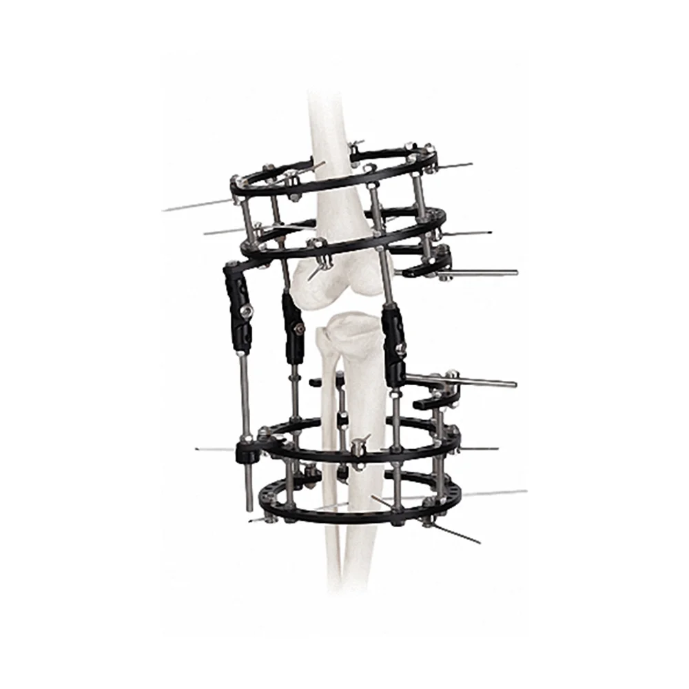 Ilizarov China Manufacturer OF Ring Tibia Femur Medical Orthopedic Device External Fixation