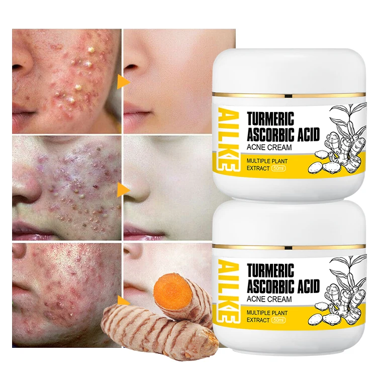 AILKE Private Label Anti-Acne Papules Removal Turmeric Face Organic Best Anti Aging Cream For Women