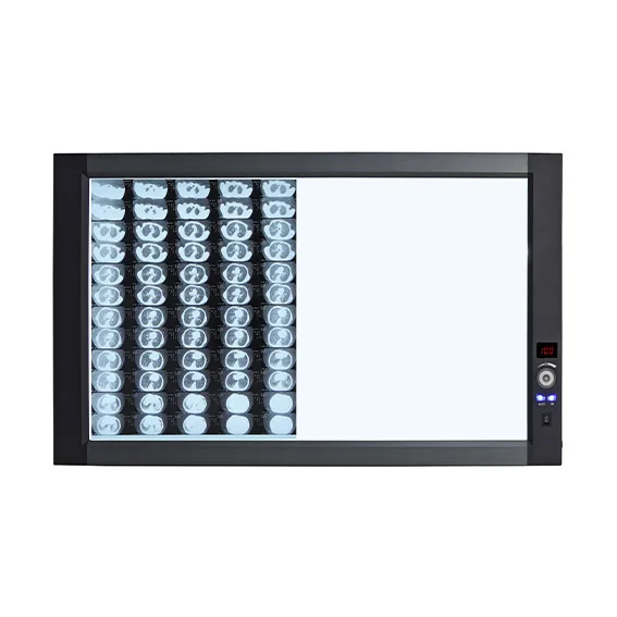 836x500x25mm Double Panel Automatic Sensing Function LED Negatoscope X-Ray Film Viewer